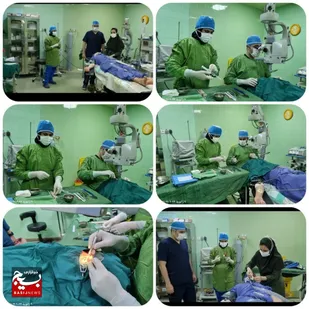 اولین پیوند سلول های بنیادی به قرنیه در فارسان