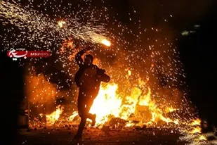 حادثه&zwnj;ای دیگر در شب چهارشنبه آخر سال یزد/انفجار ترقه موجب پارگی دست خانم ۳۷ ساله شد