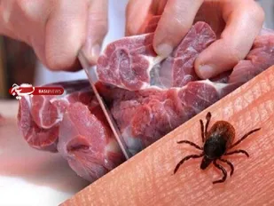 یک مورد تب کریمه در ایلام شناسایی شد