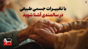 تغییرات جسمی طبیعی در سالمندی و چگونگی پذیرش آن