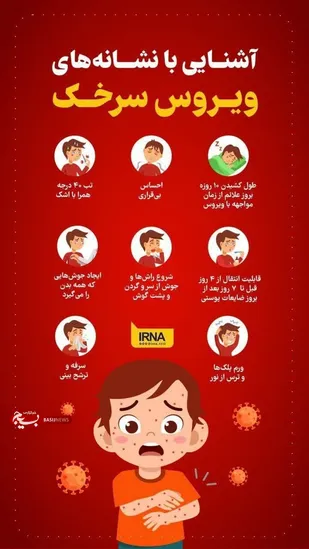 اینفوگرافی/ آشنایی با نشانه های ویروس سرخک